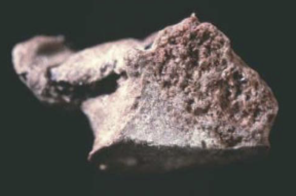 Photo sur fond noir d'une pierre à la couleur gris clair très caractéristique constituée par les reins suite à un traitement par amoxicilline, un antibiotique. 