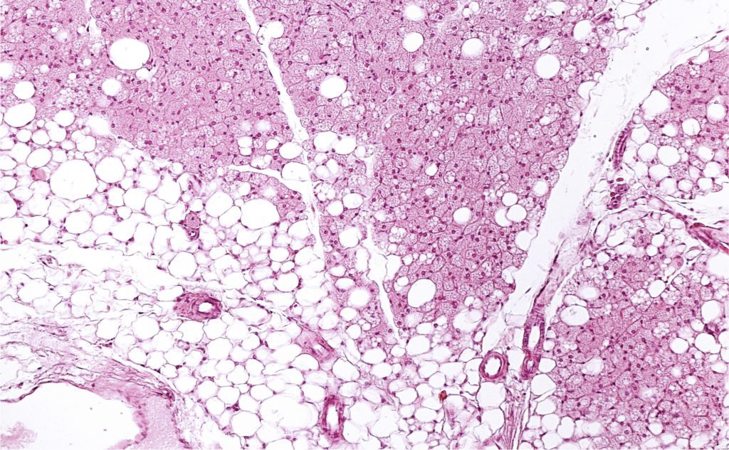 Les adipocytes blancs (en bas) présentent un aspect uniforme alors que les adipocytes bruns (en haut) ont l'air spongieux