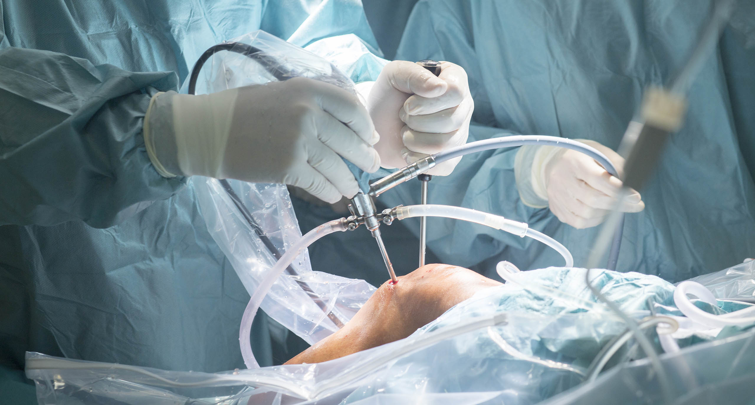 opération chirurgicale du genou par arthroscopie dans le cas de l'arthrose