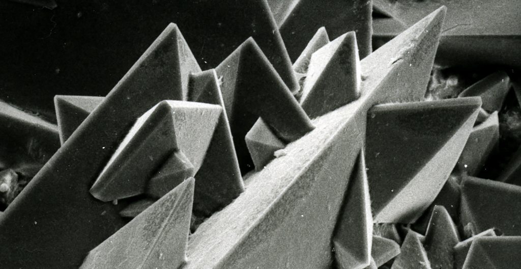 Cristaux de weddellite (oxalate de calcium dihydraté) sur la surface d'un calcul rénal. Image de microscopie électronique à balayage (MEB), énergie 30 kV, surface dans la réalité = 0,35 x 0,45 mm
