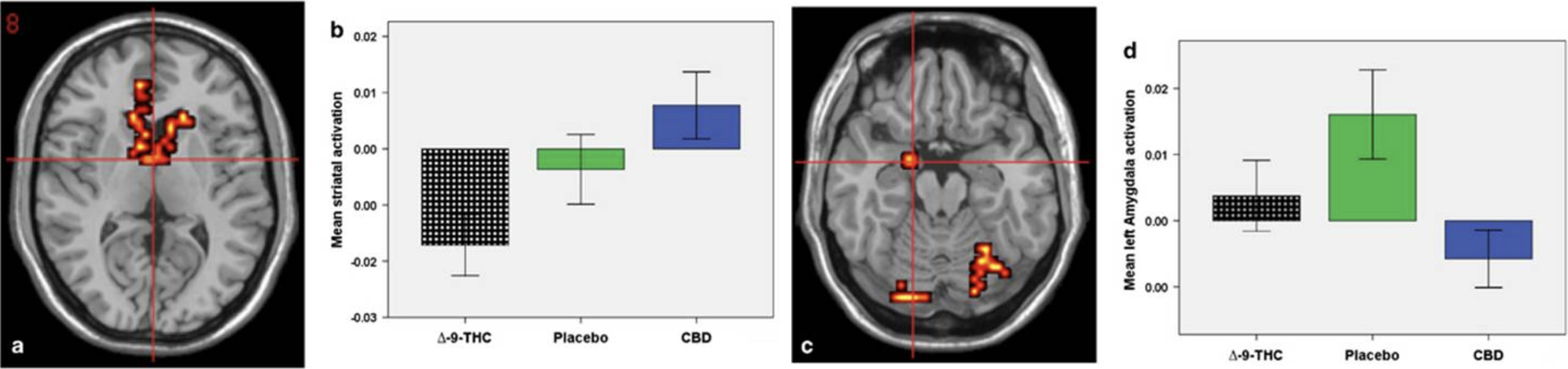 réactions du cerveau au CBD et au THC