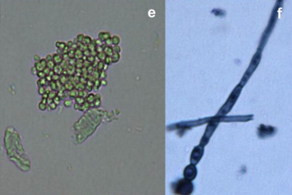 Photos microscopiques de micro algues et de champignons dans de la spiruline