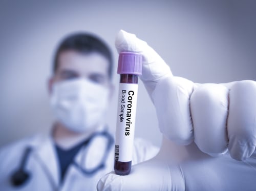 Prise de sang PCR pour diagnostiquer le coronavirus