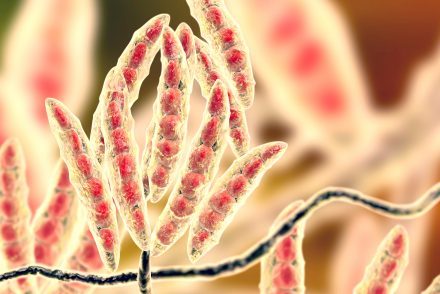 Quel est le rôle des mycotoxines dans les maladies inflammatoires chroniques de l’intestin ?
