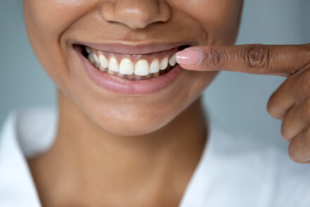 Parodontite : les oméga-3 pour la santé des gencives