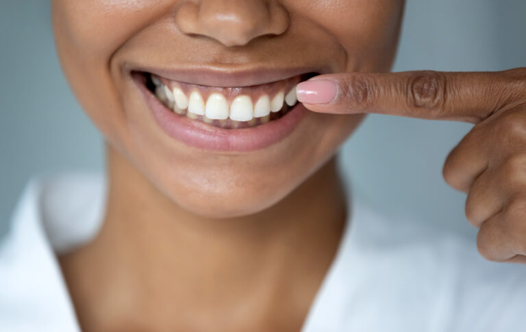 Parodontite : les oméga-3 pour la santé des gencives