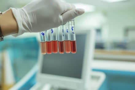 tubes de tests sanguins contenant plusieurs groupes sanguins diférents