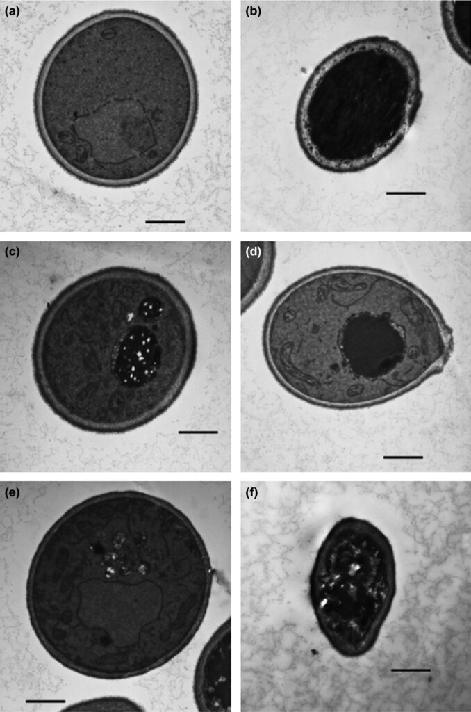 Levure Candida albicans intacte (a) en comparaison des effets destructeurs du clotrimazole  (b), de l'huile essentielle d'origan (c et d) et de sarriette d'hiver (e et f)