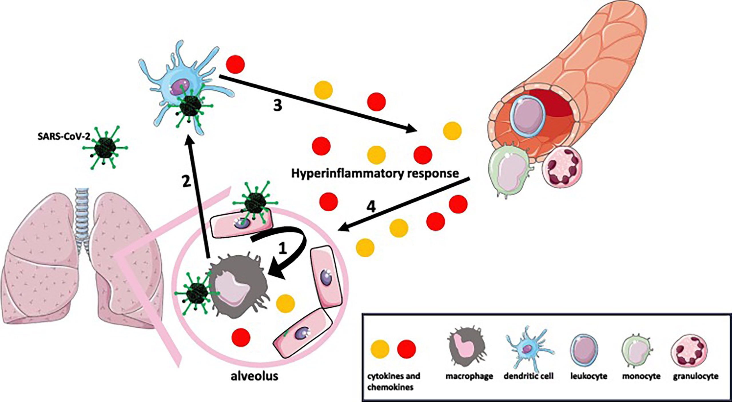 Mécanisme de l'orage de cytokines suite à une infection de Covid-19