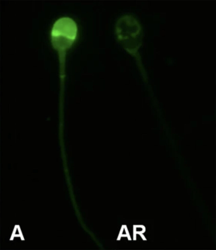 Le spermatozoïde de gauche n'est pas fécondant comme en témoigne la fluorescence au niveau de sa tête