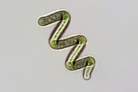 Photo de spiruline au microscope électronique