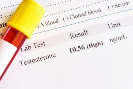 résultat d'une prise de sang montrant un taux de testostérone élevé