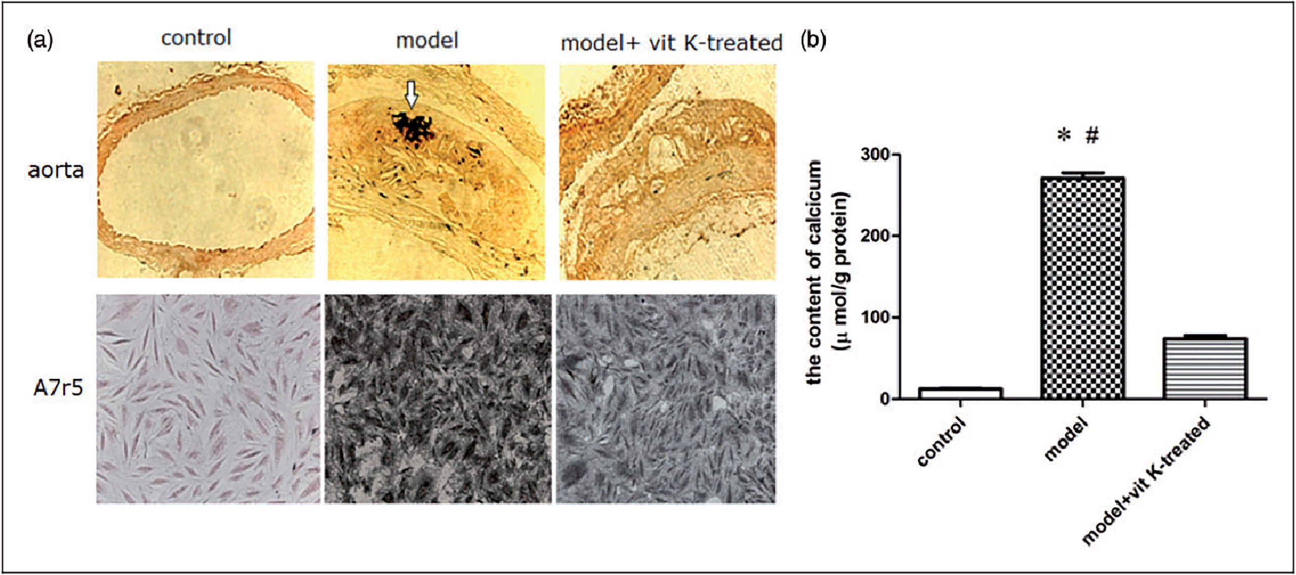 La vitamine K2 prévient la calcification des artères - ici sur un modèle animal de souris